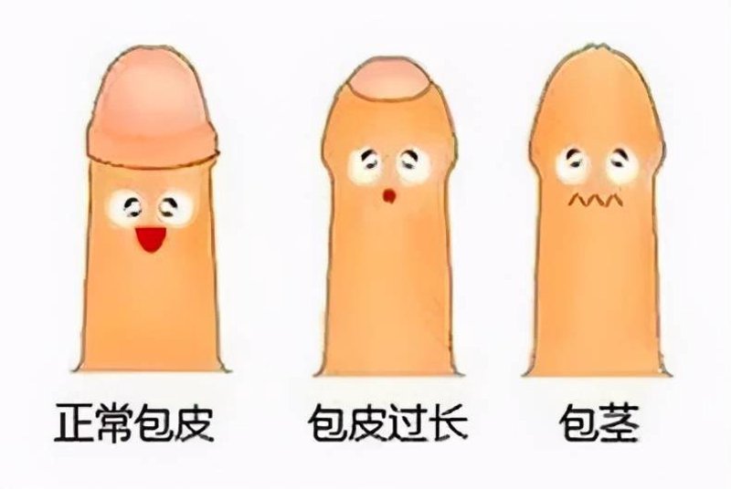 你是否因为对包皮手术的不了解而感到困惑？如果你正考虑进行包皮手术，或许你已经遇到了这样的问题：我该去哪个科室挂号呢？这篇文章将通过对比和解析来帮助你找到答案。